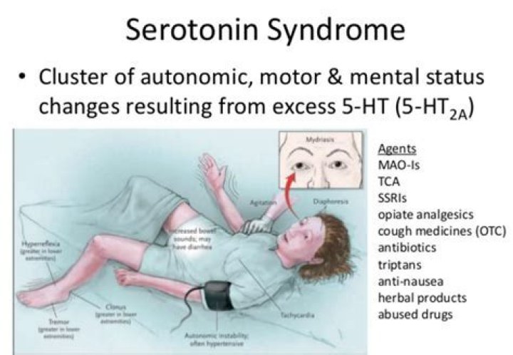 What does the beginning of serotonin syndrome feel like?