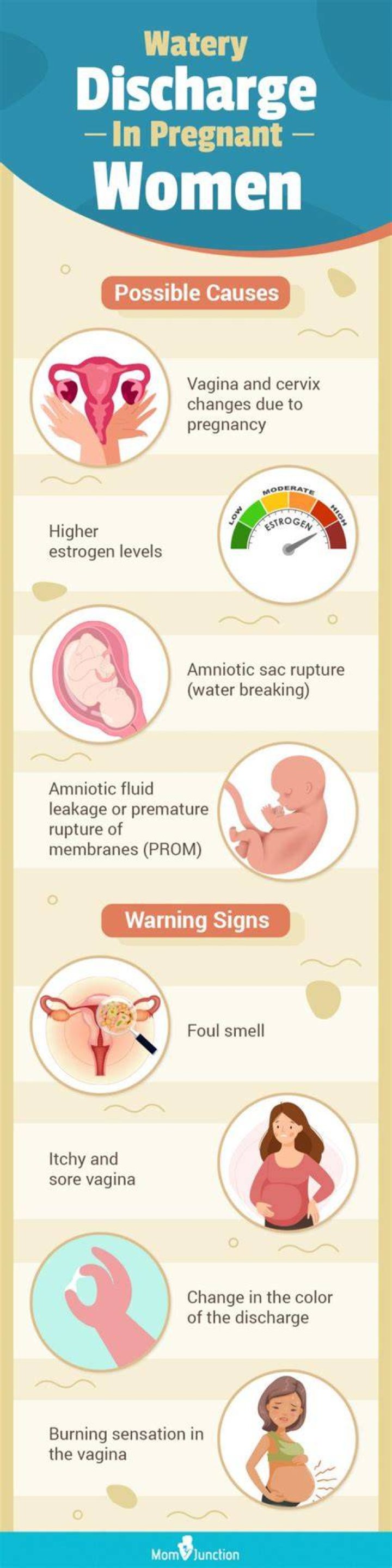 What does the discharge look like when pregnant?