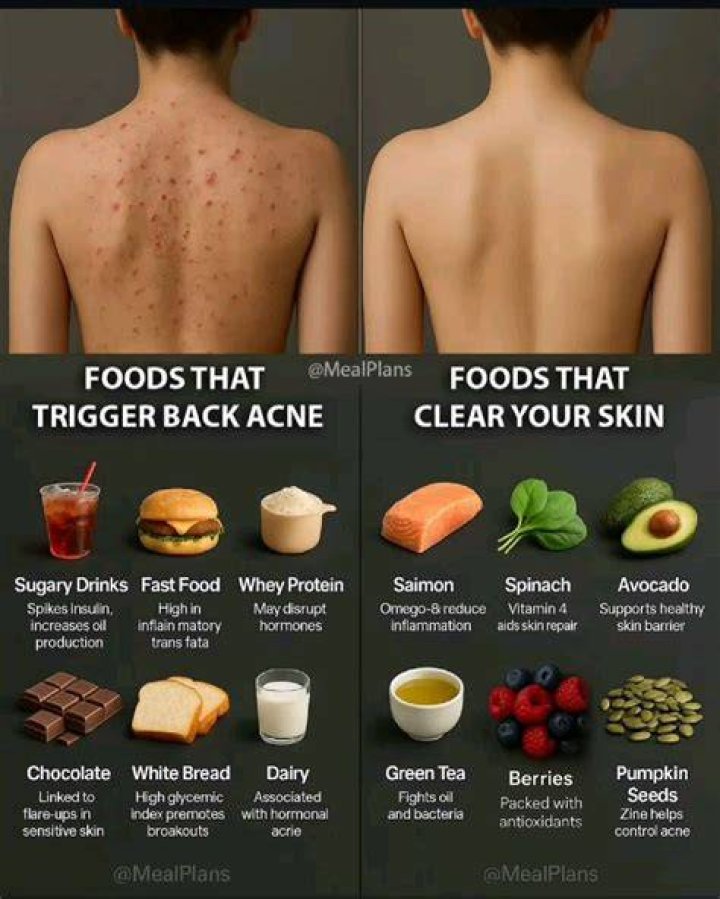What foods cause dry skin?