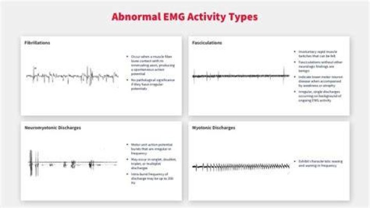 What happens if EMG is abnormal?