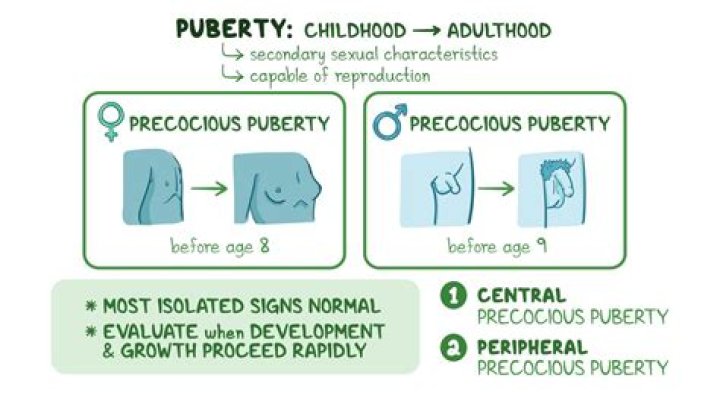 What happens if precocious puberty is not treated?