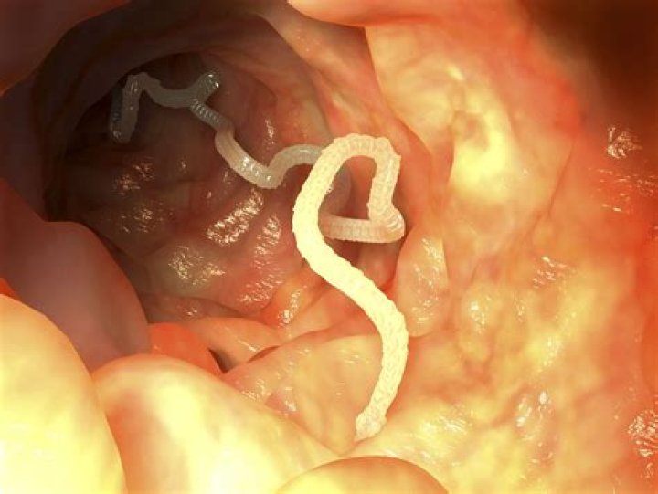 What happens if worms are left untreated in humans?