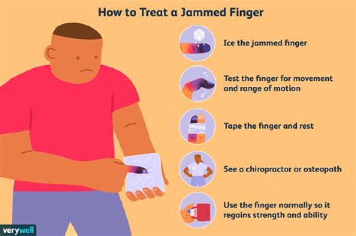 What happens if you don't ice jammed finger?