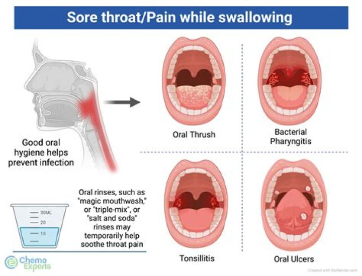 What happens when you get a throat infection?