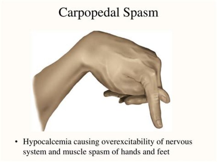 What is Carpopedal spasm?