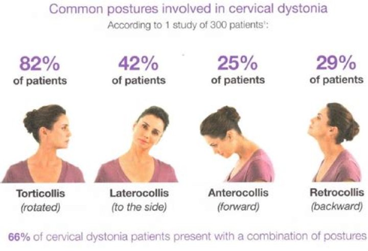 What is Dysomia?