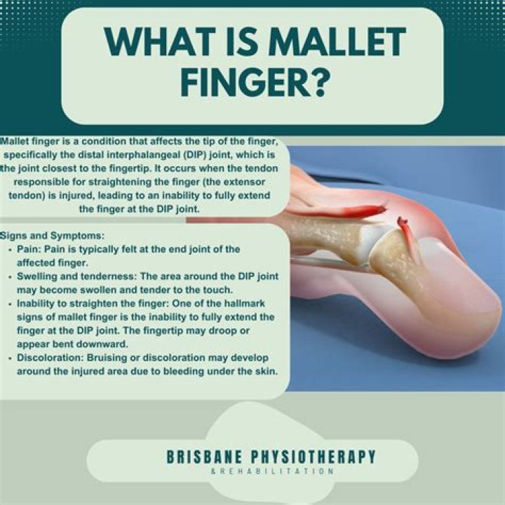 What is mallet in polo?