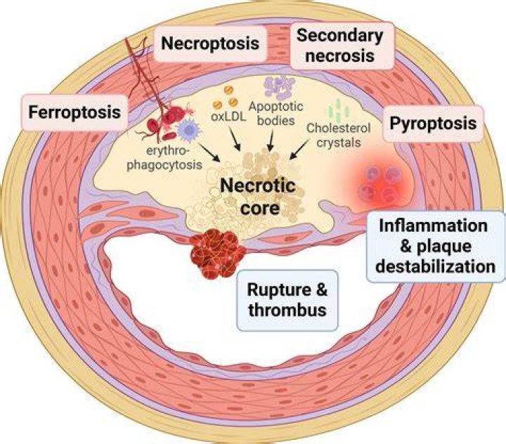 What is muscle necrosis?