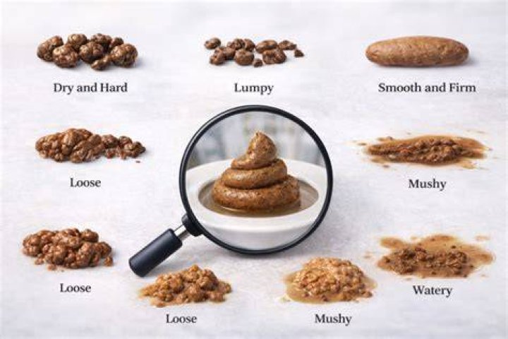 What is mushy stool?