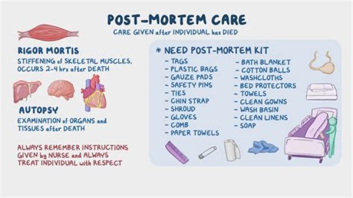 What is right mortis?