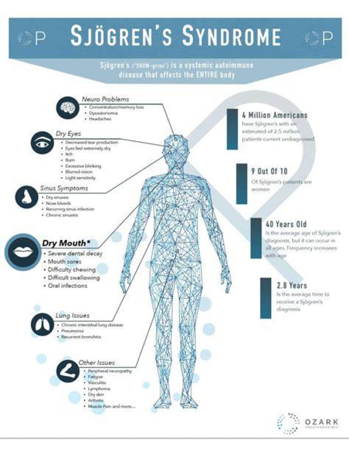 What is secondary Sjögren's syndrome?