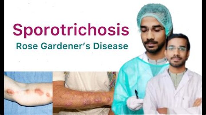 What is sporotrichosis caused by?