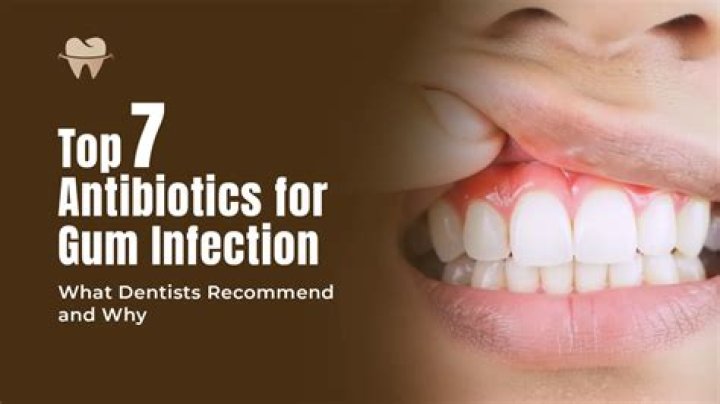 What is the best antibiotic for gum infection?