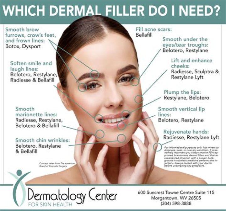 What is the best body filler?