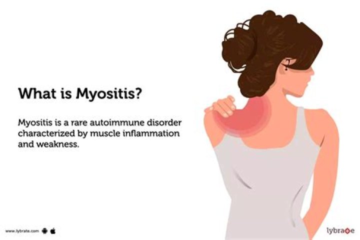 What is the best medication for myositis?