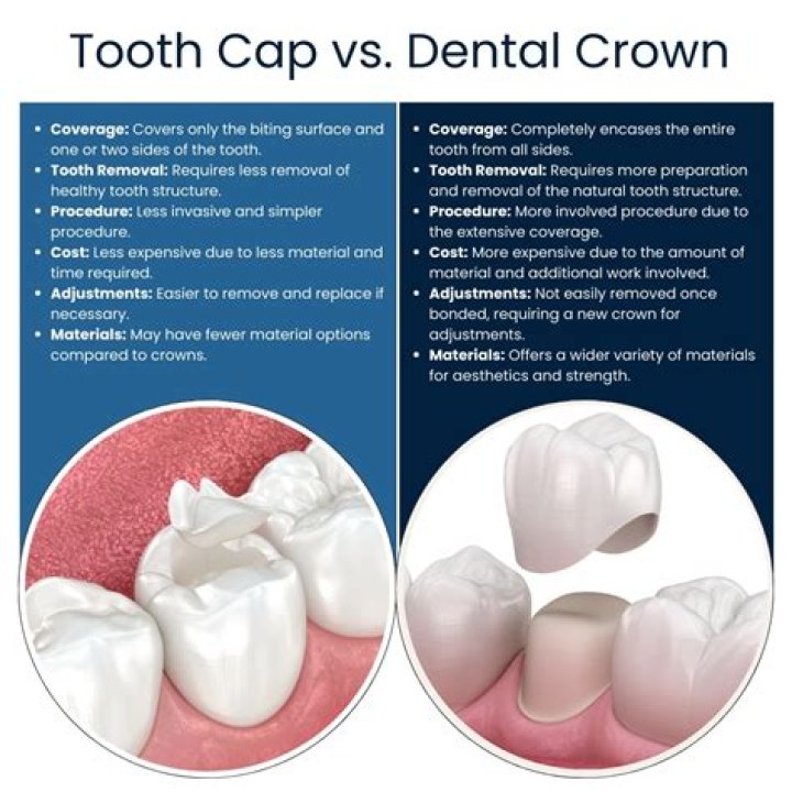 What is the difference between a cap and a crown?
