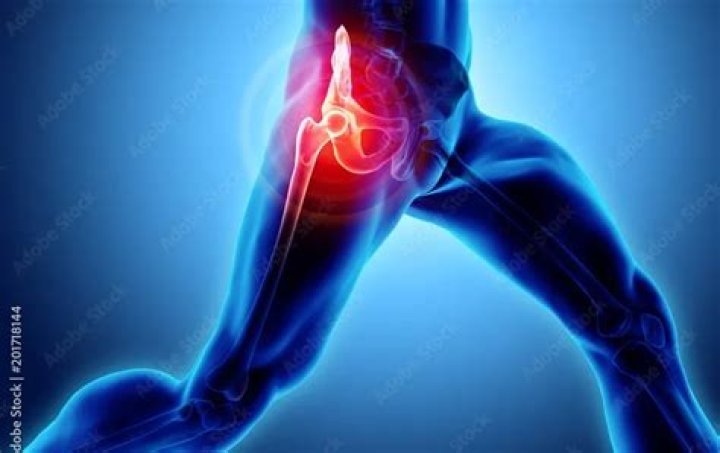 What is the fastest way to recover from a hip replacement?
