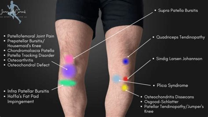 What is the fastest way to reduce inflammation in the knee?