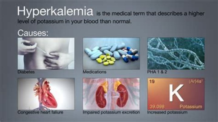 What is the main cause of high potassium?