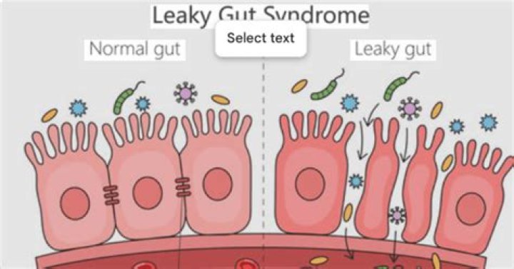What is the main cause of leaky gut?