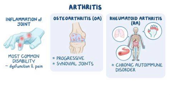 What is the most painful type of arthritis?