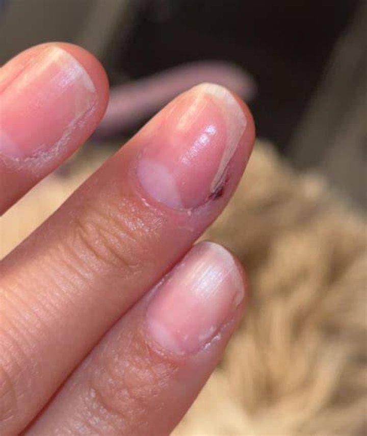 What is the white part under your fingernail?