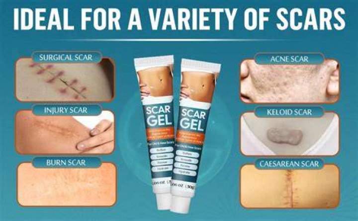 What kind of vitamin E is best for scars?