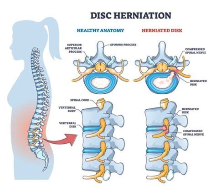 What makes a disc more or less stable?