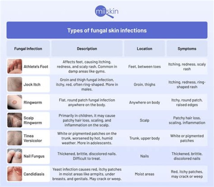 What medication is used for sporotrichosis?