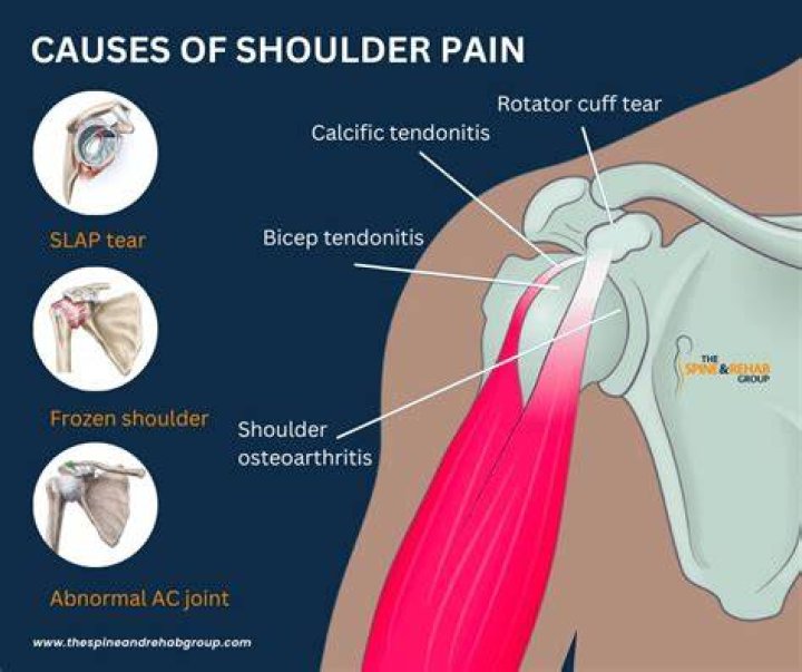 What nerve would cause shoulder pain?