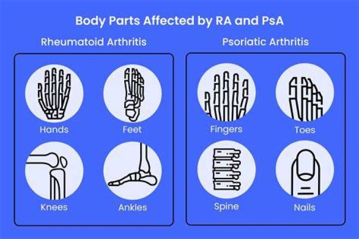 What organs are affected by psoriatic arthritis?