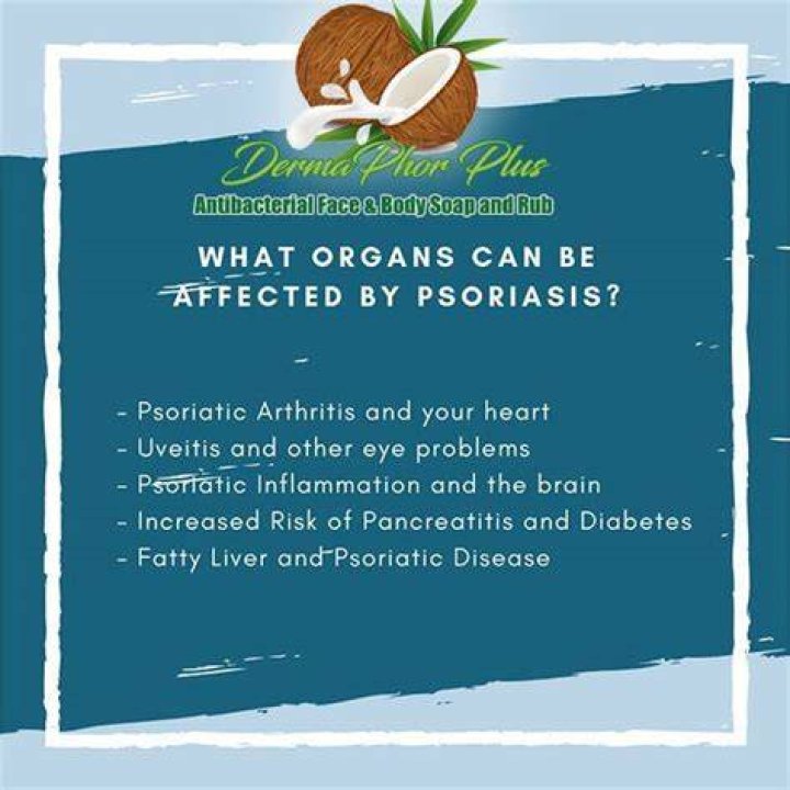 What organs can be affected by psoriasis?