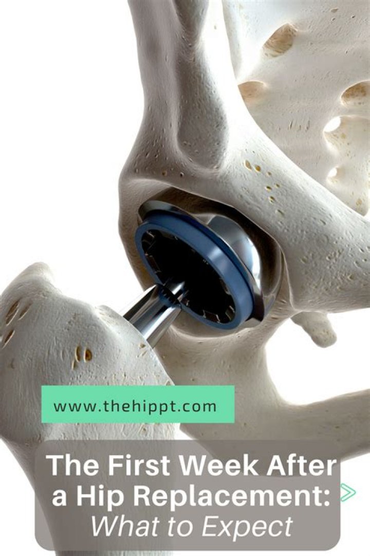 What should I be doing 1 week after hip replacement?