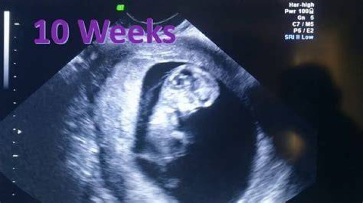 What should I feel at 10 weeks pregnant?
