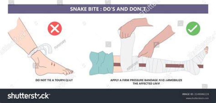 What should we do when snake bite?