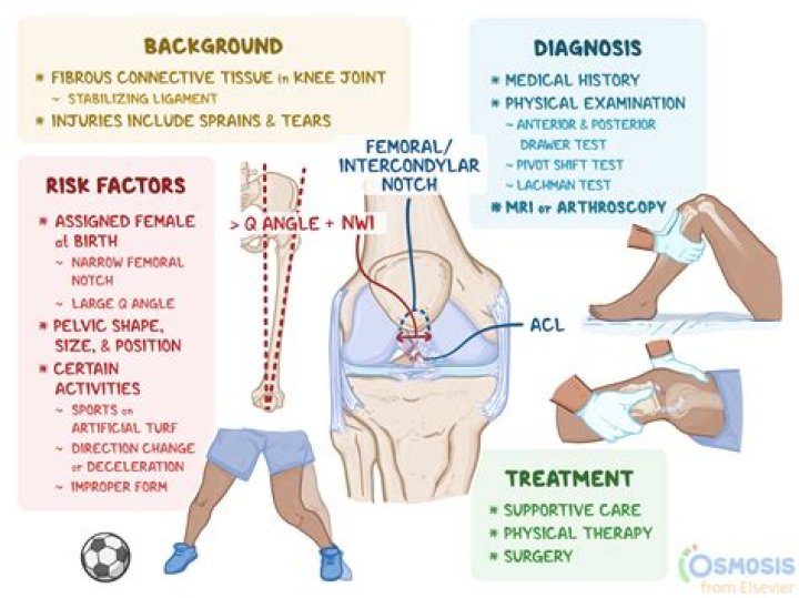What should you not do with a torn ACL?