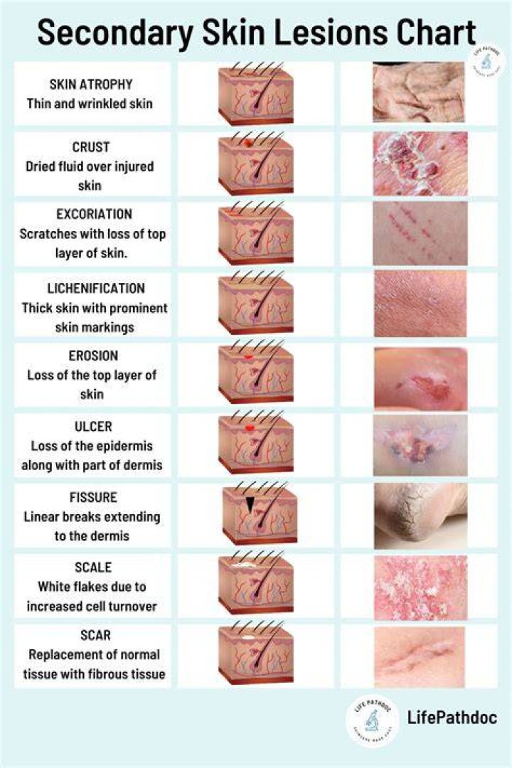 What skin condition is often life-threatening?