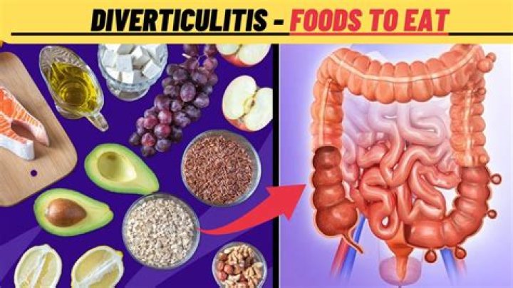 What soups are good for diverticulitis?