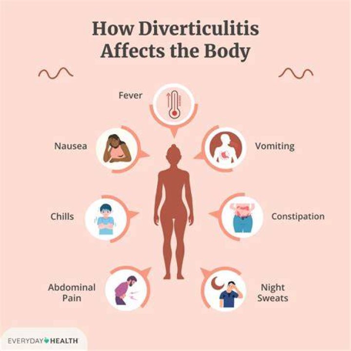 What triggers diverticulitis?