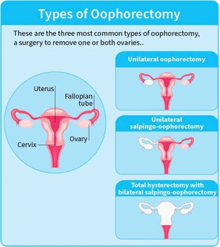 When can I sleep on my side after ovary removal?