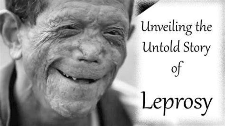 When did leprosy first appear?
