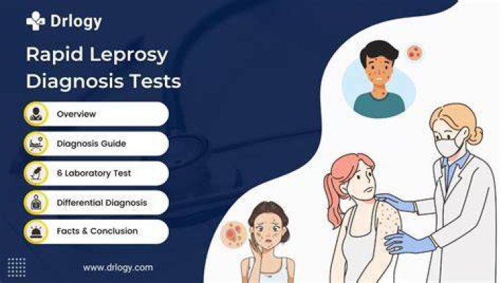 When did leprosy start and end?