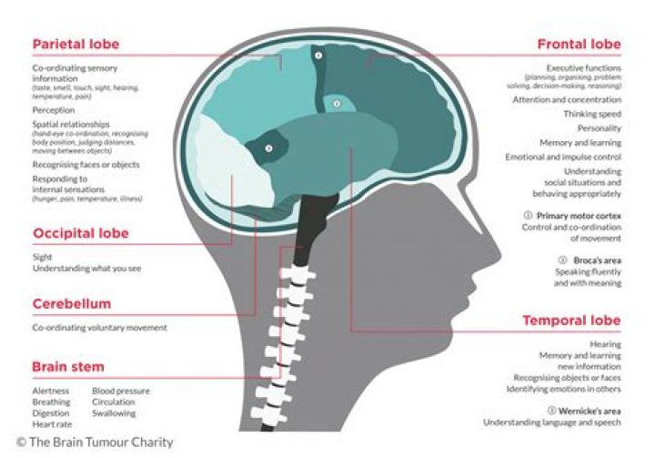 Where are brain tumor headaches located?
