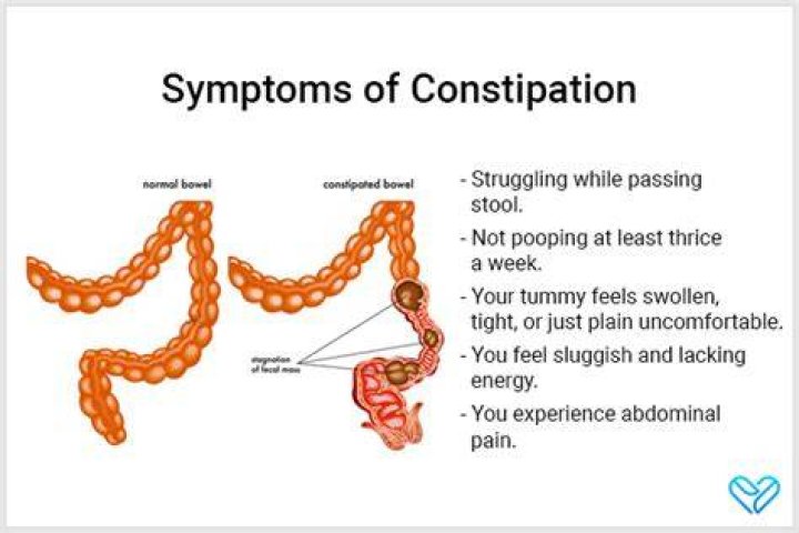 Where do you feel constipation pain?