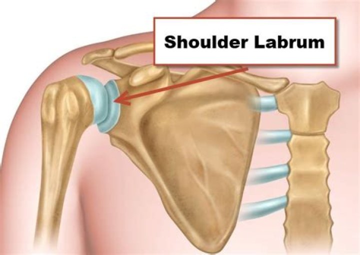 Where does labrum pain hurt?