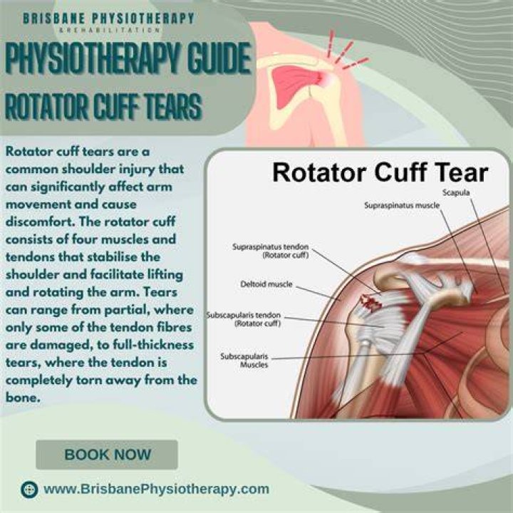 Where does your arm hurt if you have a torn rotator cuff?