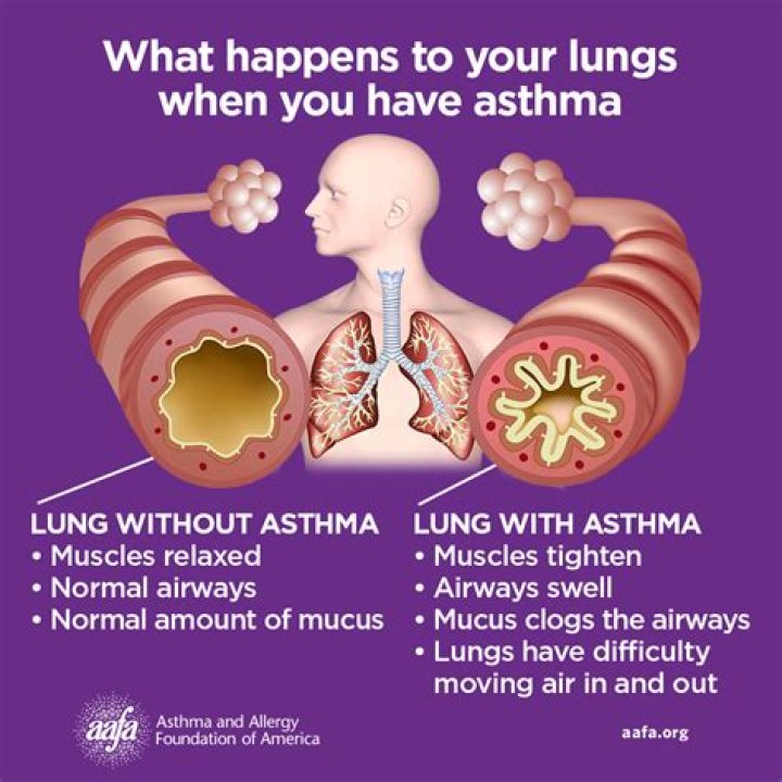 Which celebrity has asthma?