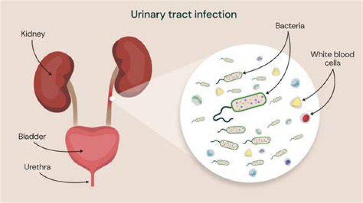 Which fruit is best for urine infection?