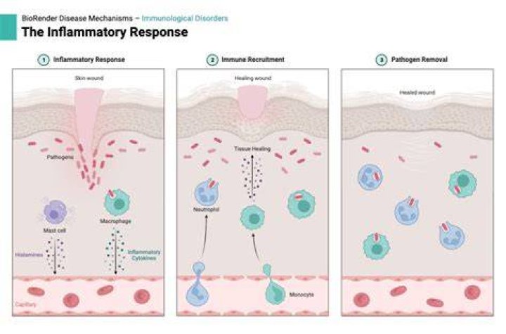 Which of the following are main functions of the inflammatory response?