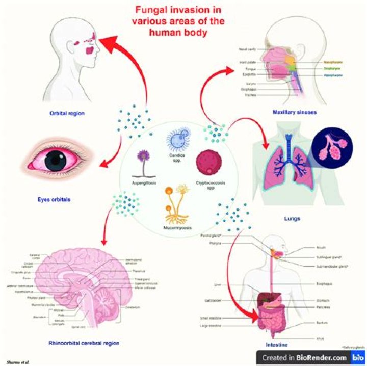 Which organ is affected by fungal disease?